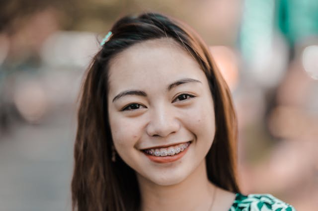 Types of Braces